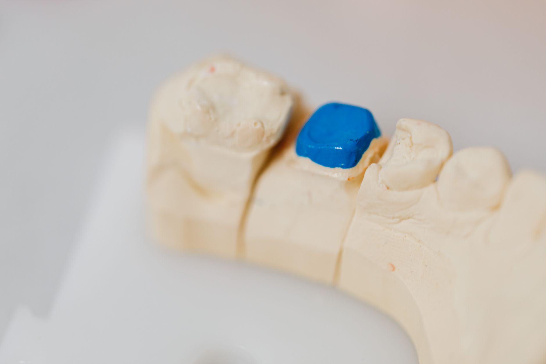 Does Getting a Dental Crown Hurt? What to Expect