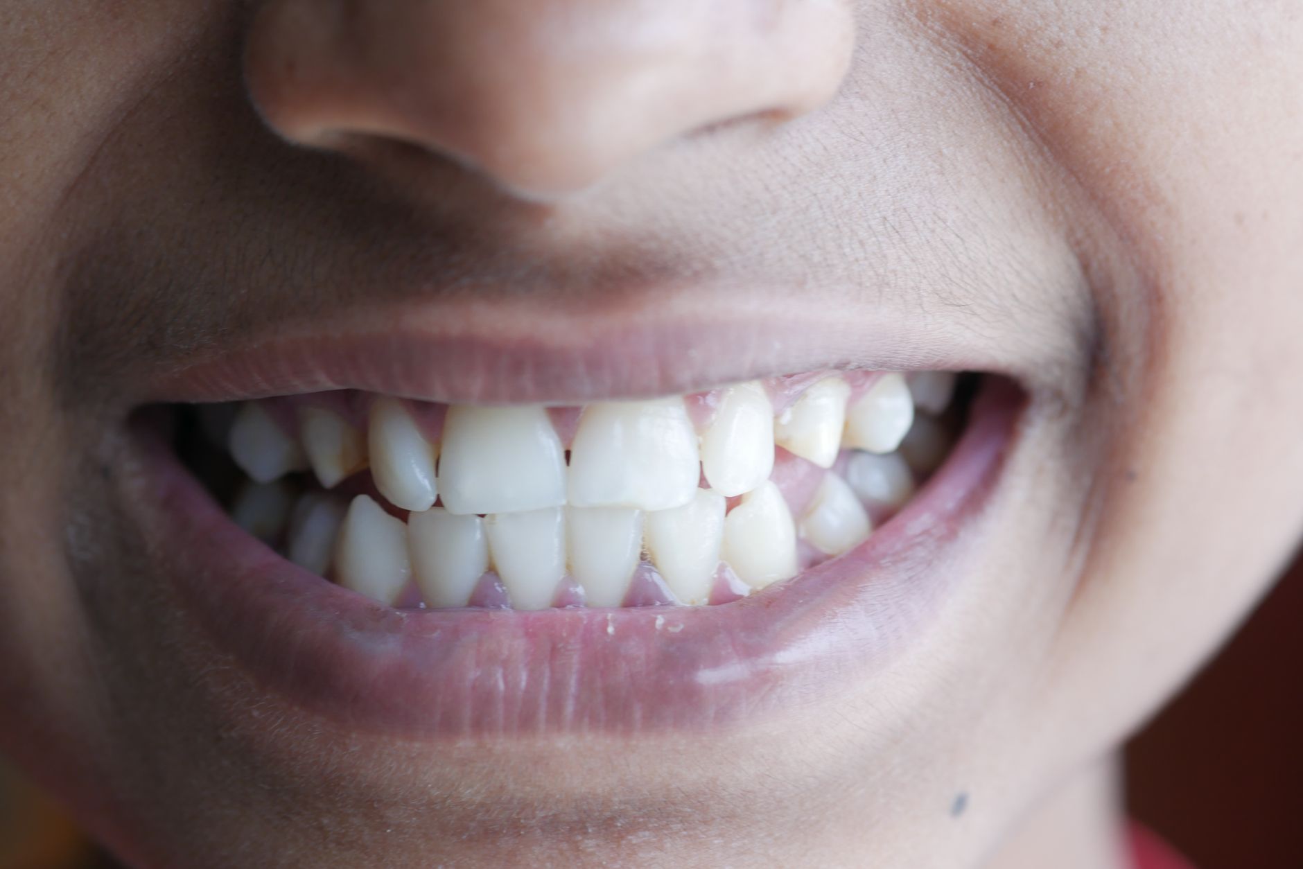 Emerging Trends in Cosmetic Dentistry to Watch Out For