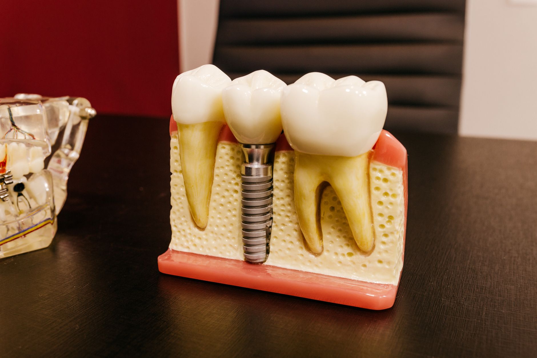 Essential Tips for a Smooth Dental Implant Recovery