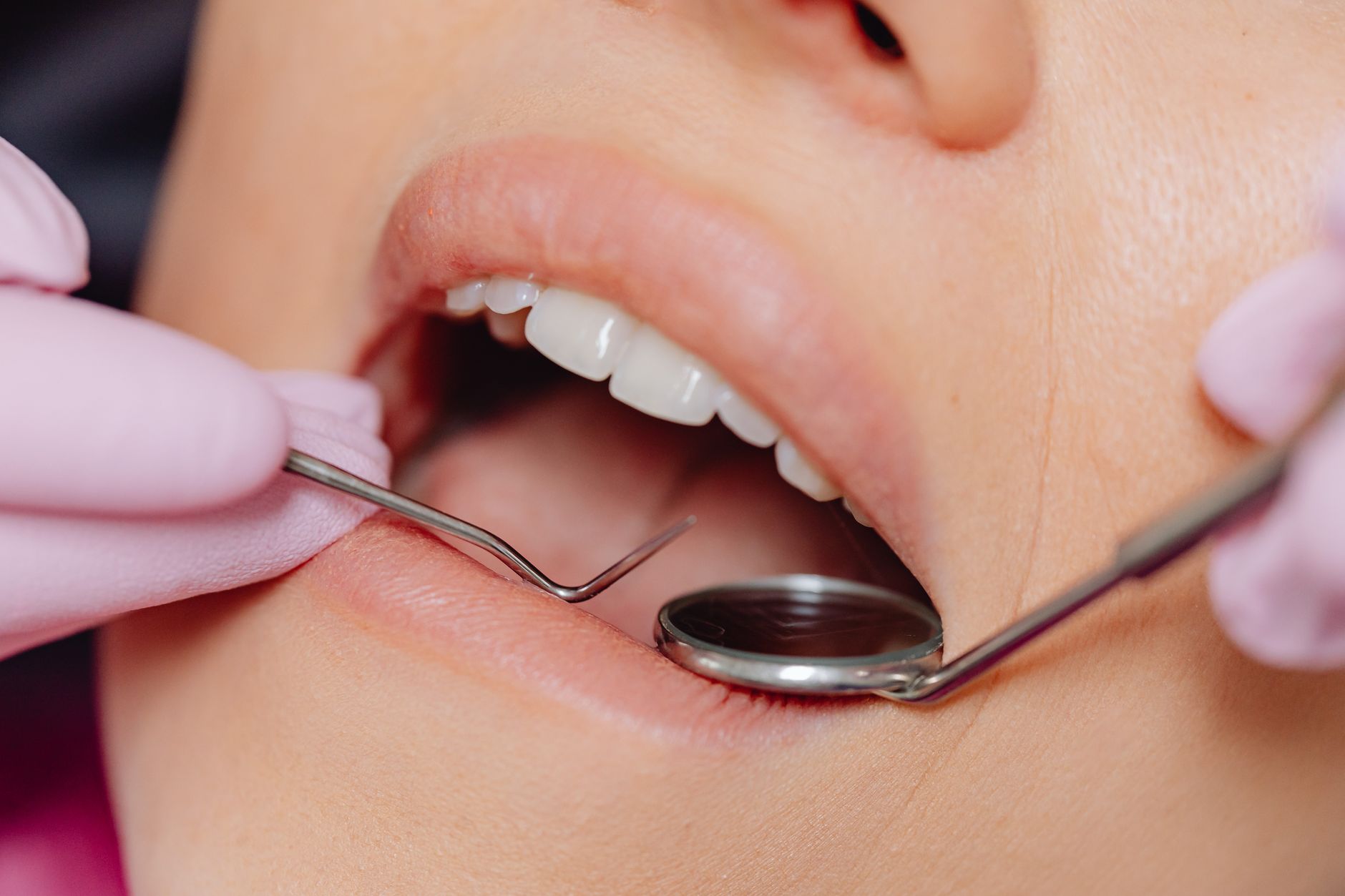 Exploring the Causes of Gum Recession