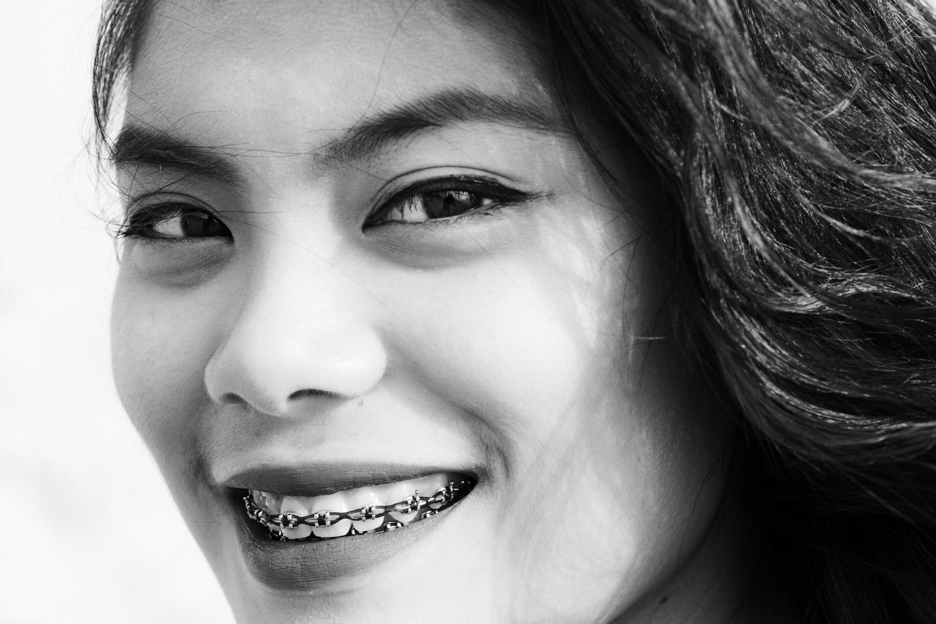 How Do Dental Braces Impact Your Eating Habits? Tips for a Smooth Transition