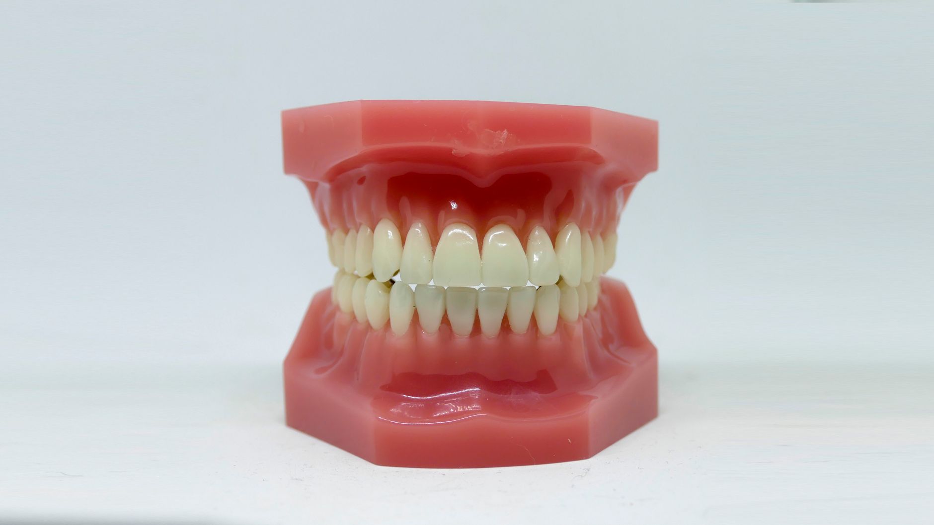 Invisalign Explained: A Modern Alternative to Traditional Braces