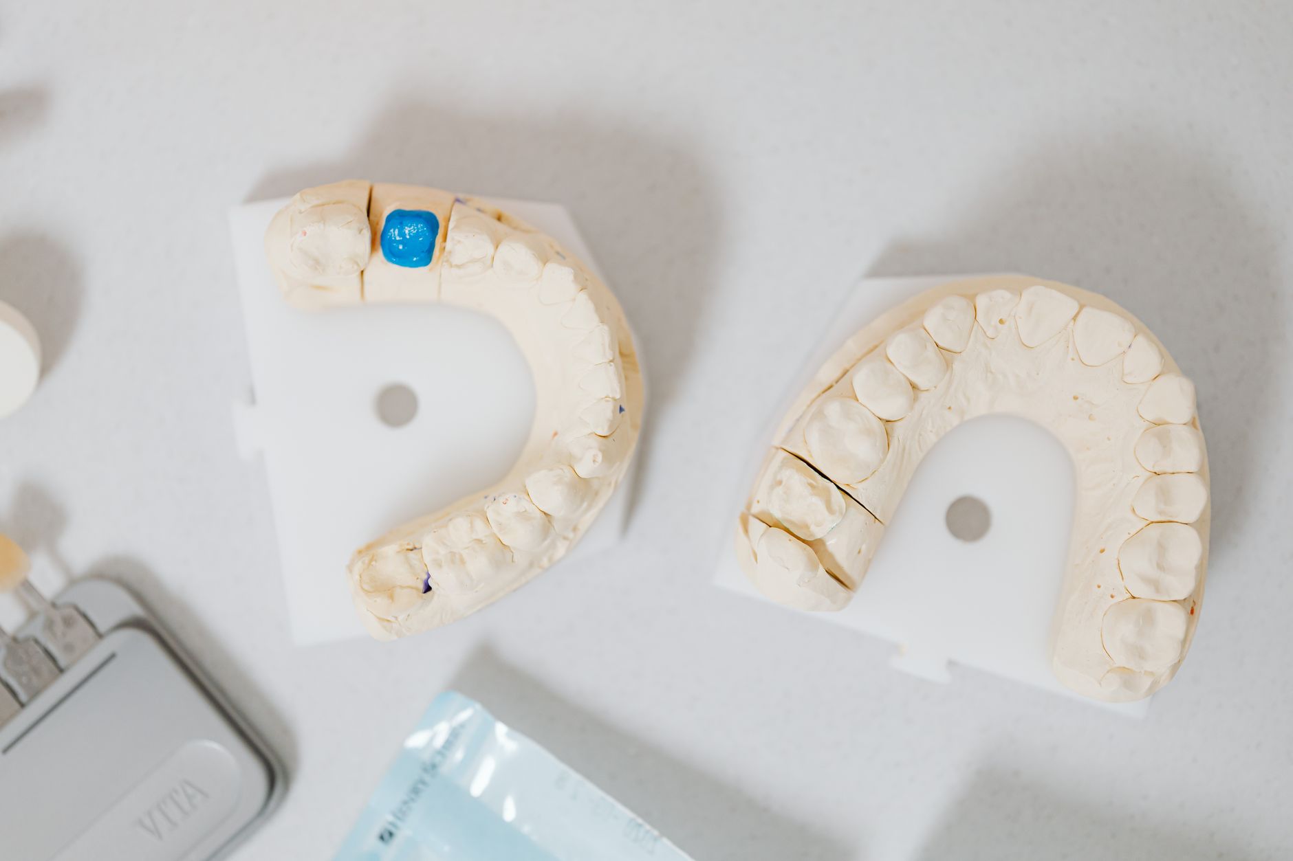 Post-Procedure: What to Expect After Getting a Tooth Restoration Crown