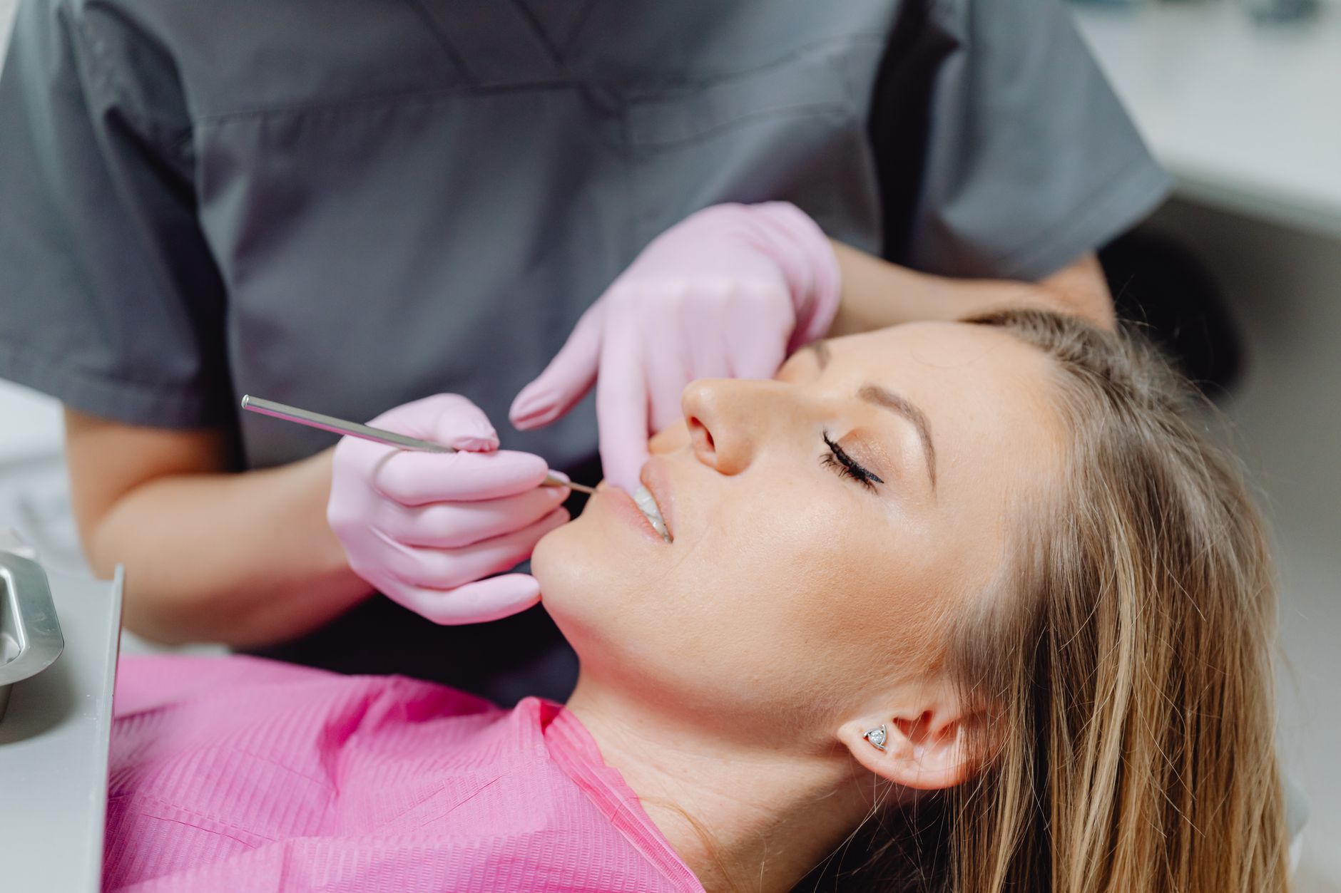 Repair Cavities with Composite Fillings: A Drill-Free Solution