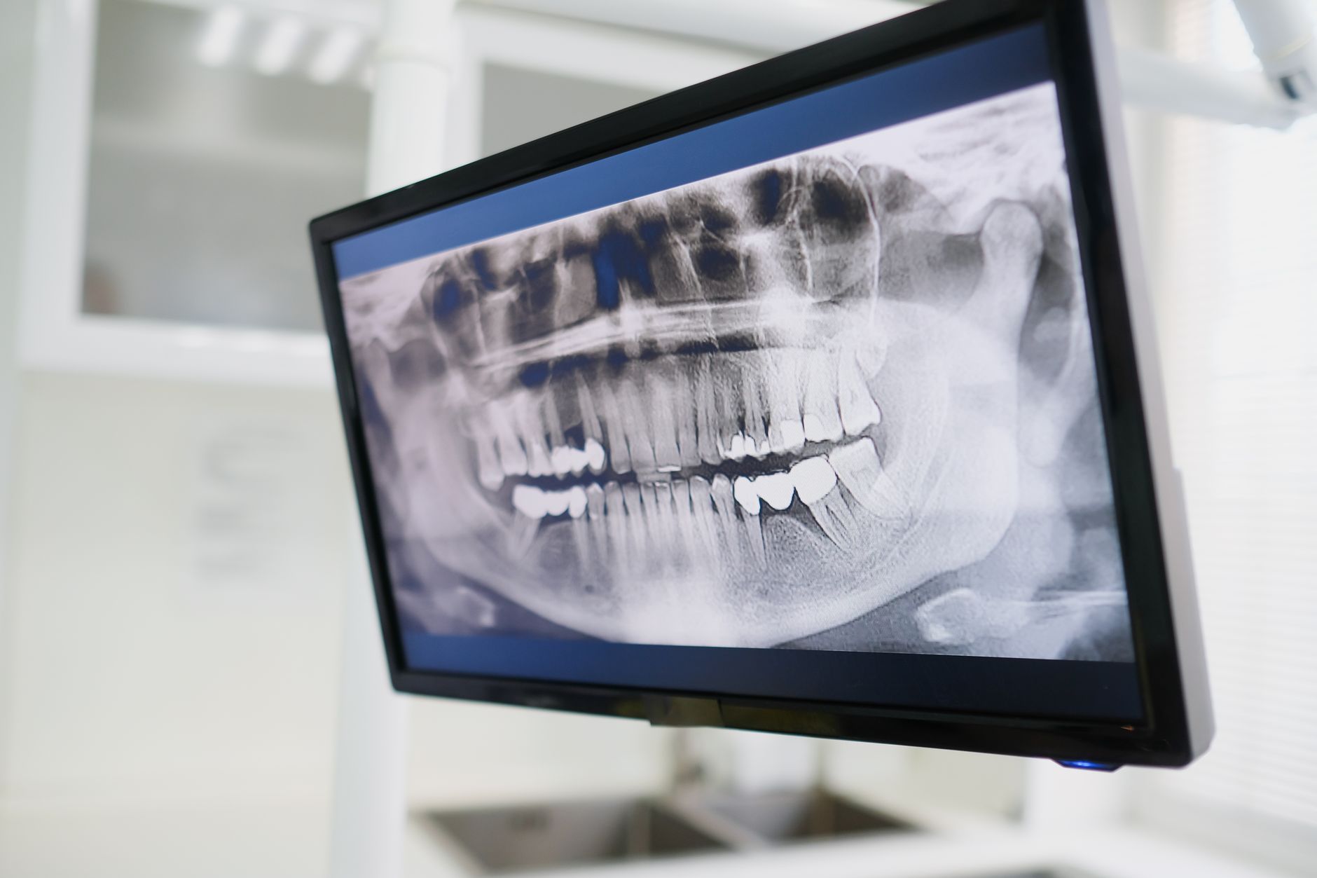 The Importance of Accurate Dental Imaging in Modern Dentistry