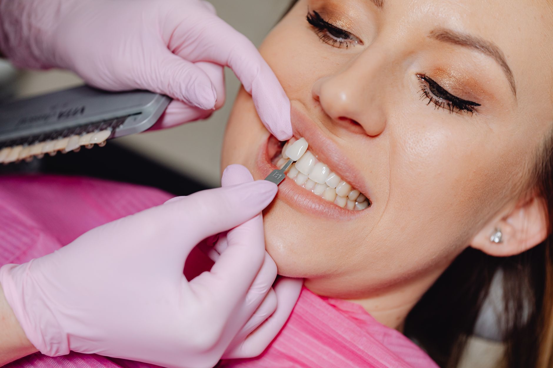 Transform Your Smile: How Veneers Can Make a Difference