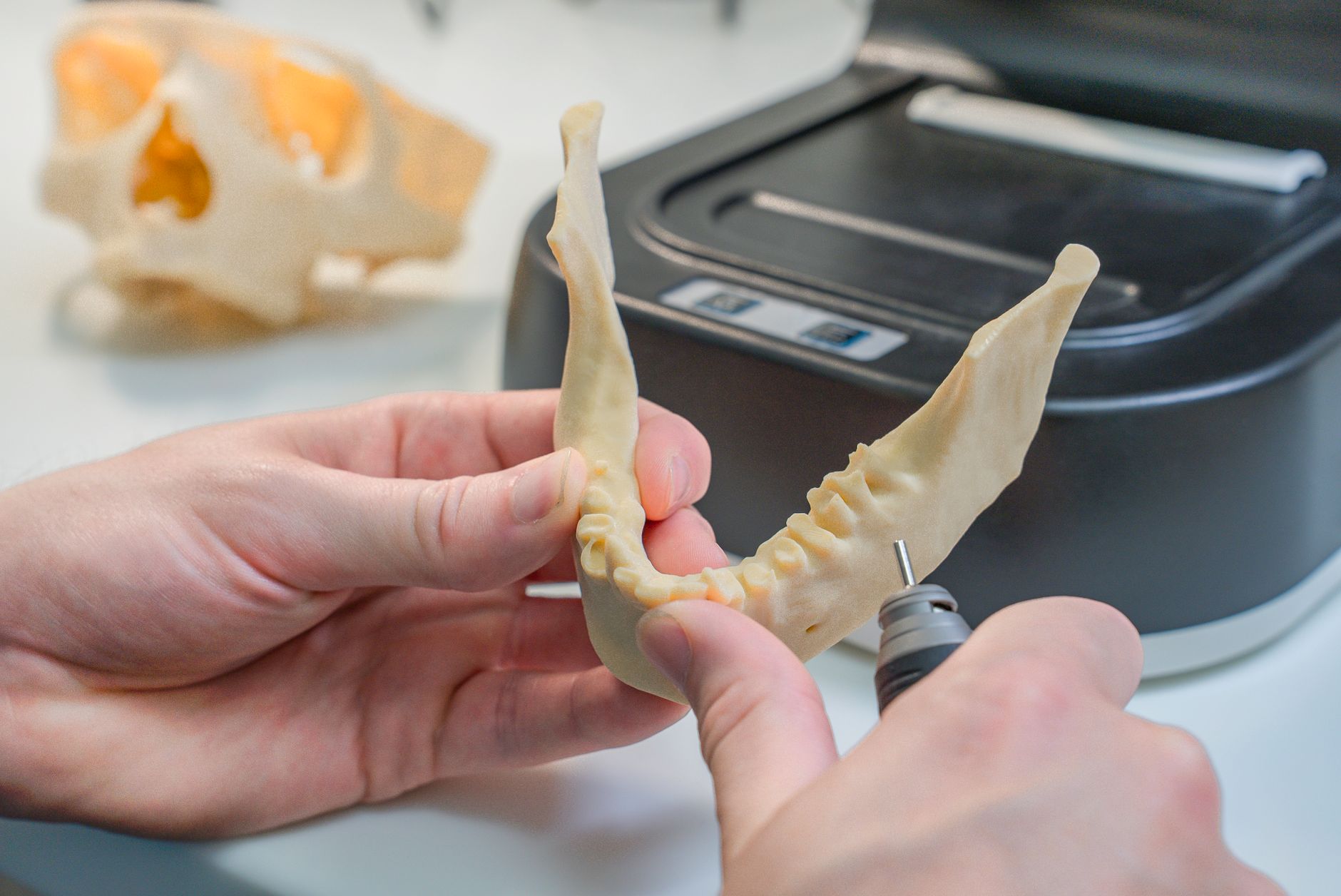 Can You Get a Dental Implant on the Same Day as a Tooth Extraction?